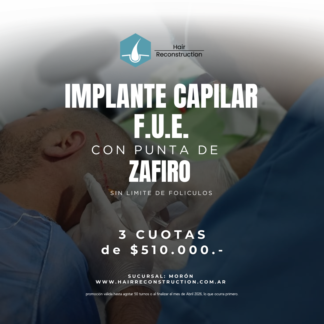 PROMO hasta Abril 2026 de Implante Capilar